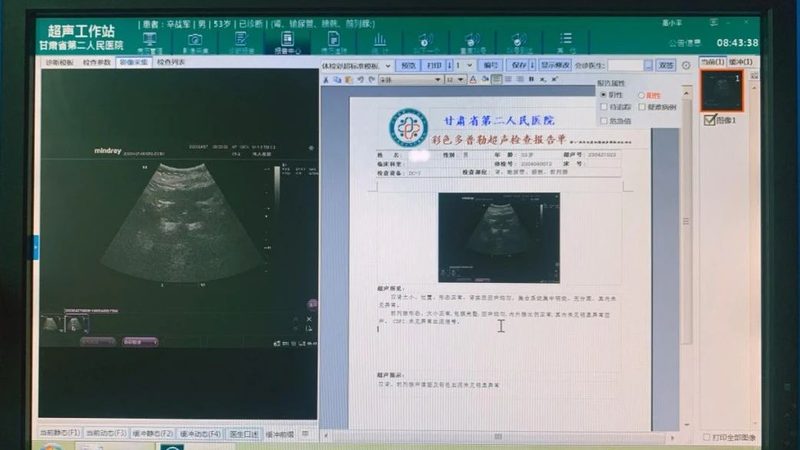 噪音岗位职业体检标准要求